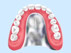 食事がおいしく食べられる「金属床義歯」（チタン・コバルトクロム）