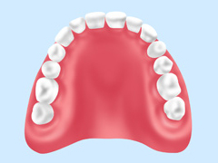 保険適用の一般的な入れ歯「レジン床」