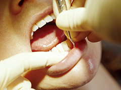 歯を失う原因の1位が歯周病